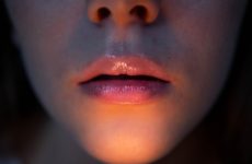 How CBD Lip Balm Could Help Save Your Lips